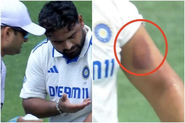 Rishabh Pant Takes Brutal Blow on Arm, Injured Part Swells Instantly [WATCH]